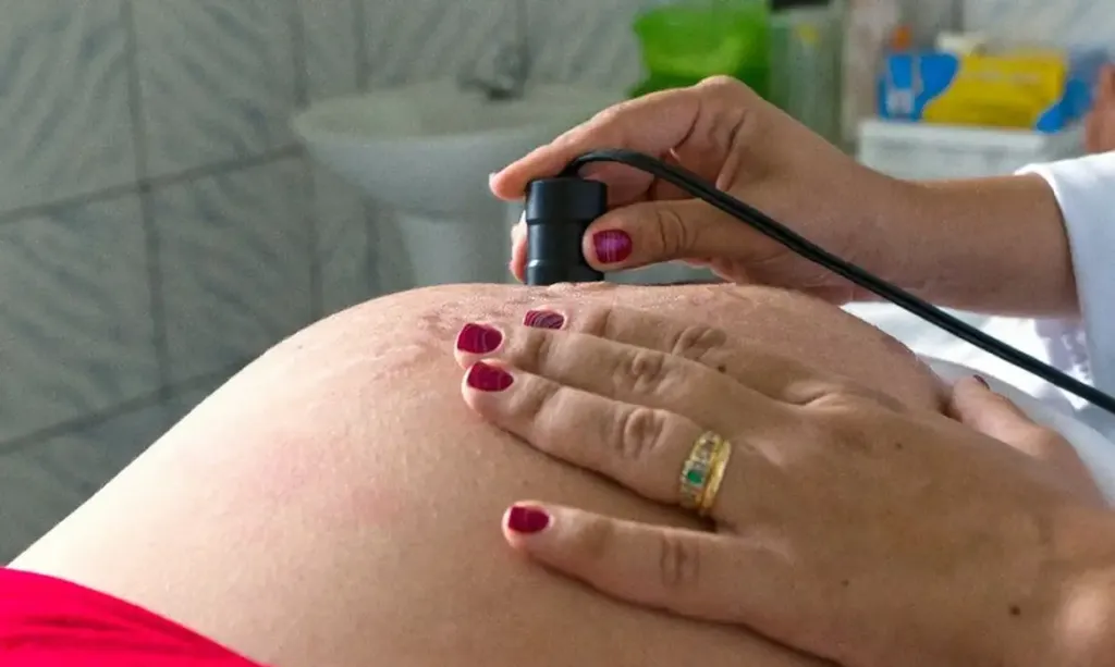 Assistência ao parto avança no Brasil, mas pré-natal ainda preocupa